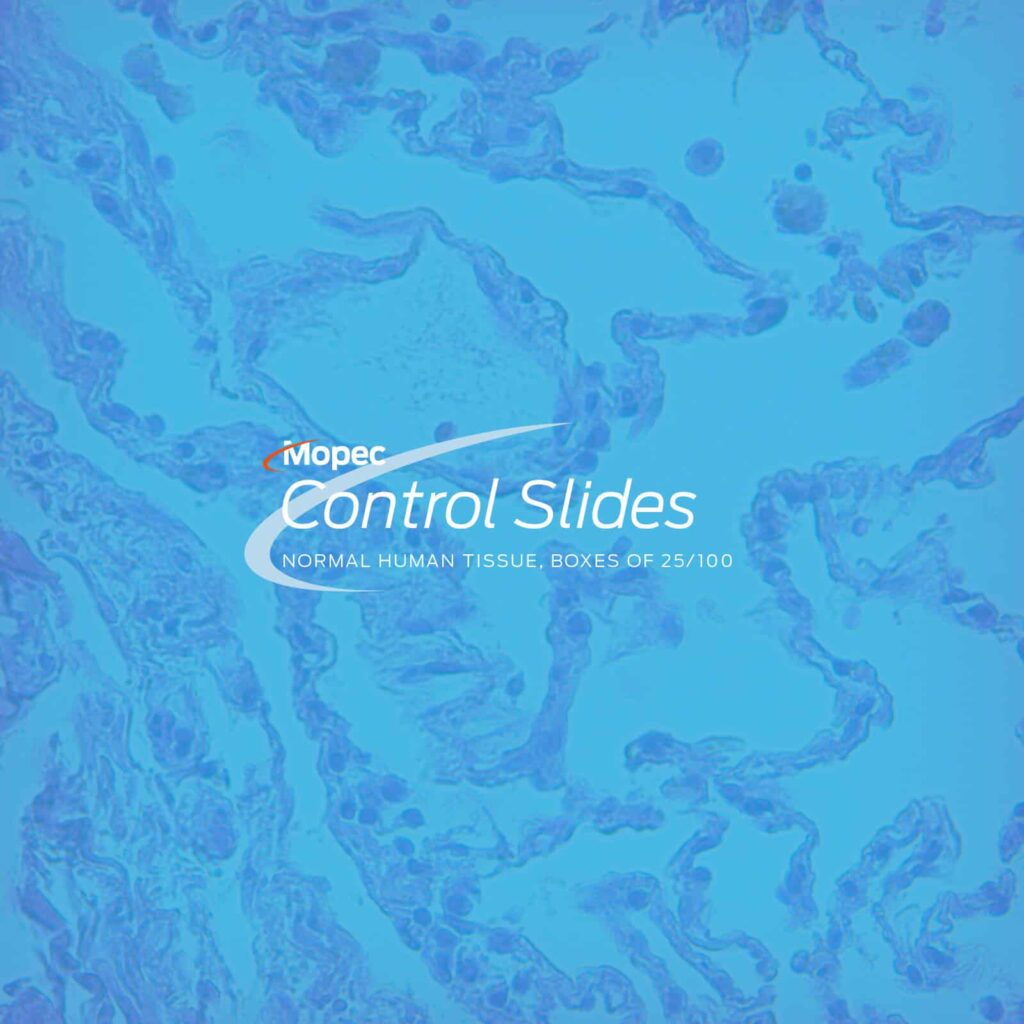 Control Slides Normal Human Tissue Placenta Boxes Of 25 100 control-slides-normal-human-tissue-placenta-boxes-of-25-100